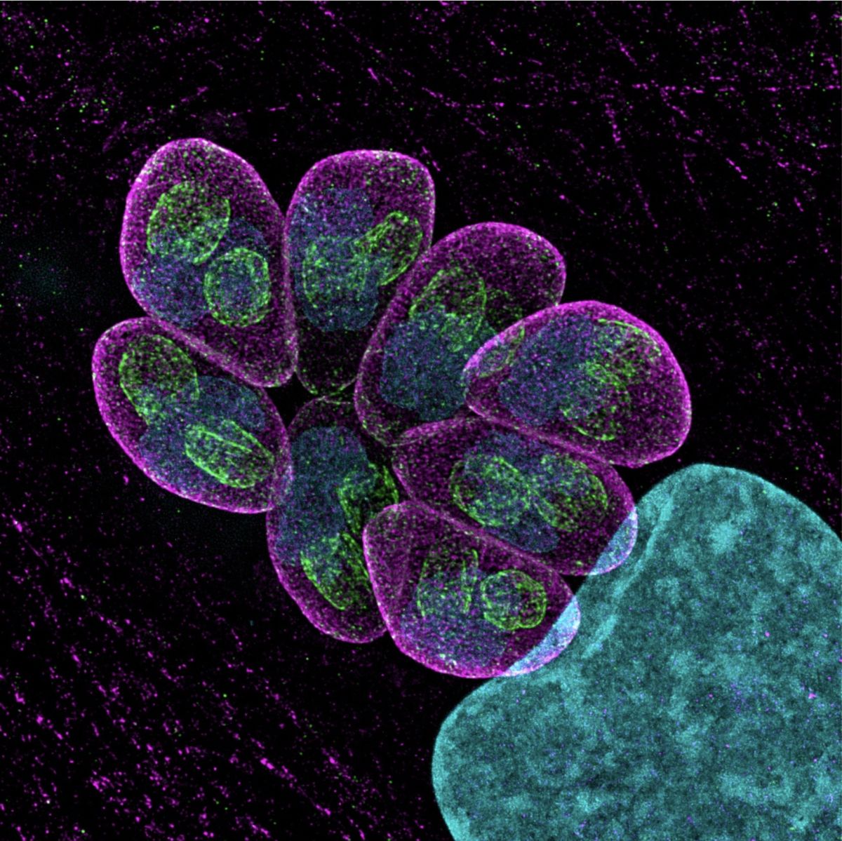 TgGCN5b, un régulateur épigénétique central de la croissance et de la virulence de Toxoplasma gondii